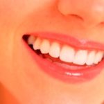 歯の着色の原因はなんだろう？