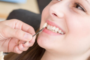 ホワイトニングができない人っているの？体への影響は？？